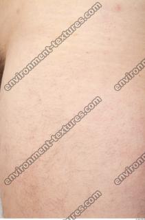 photo texture of white skin